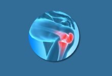 how to cure knee pain